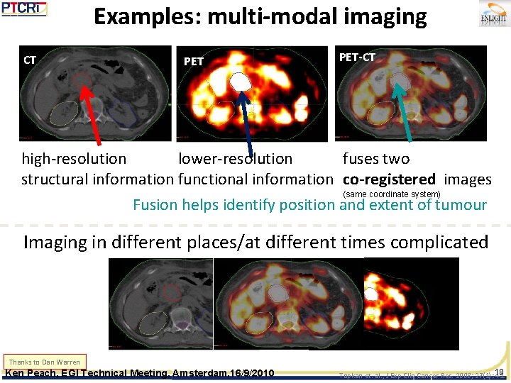 Examples: multi-modal imaging CT PET-CT high-resolution lower-resolution fuses two structural information functional information co-registered