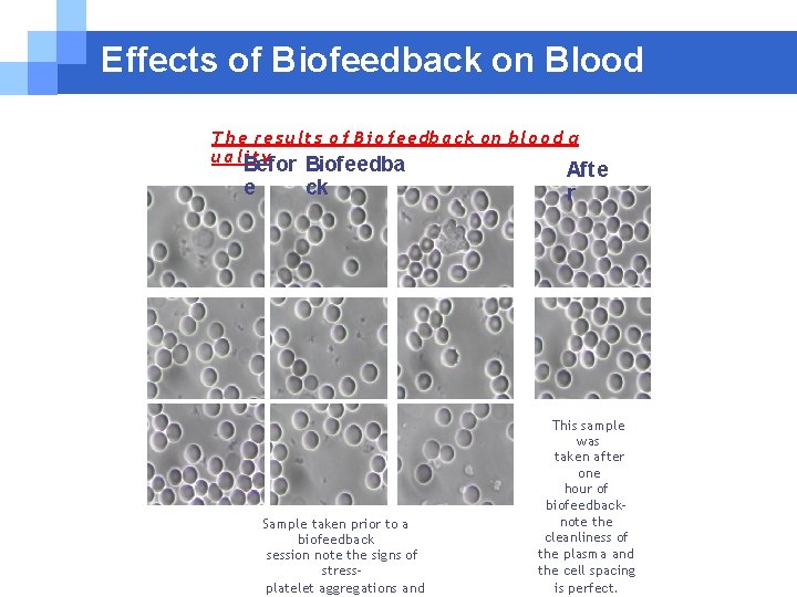 Effects of Biofeedback on Blood T h e r e s u l t Effects of Biofeedback on Blood T h e r e s u l t