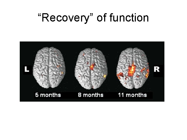 “Recovery” of function 