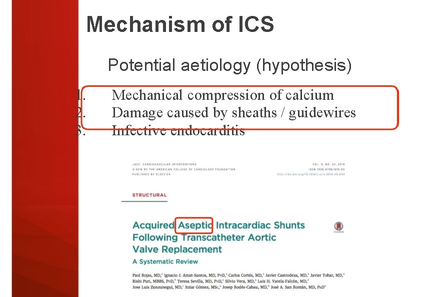 Mechanism of ICS Potential aetiology (hypothesis) 1. 2. 3. Mechanical compression of calcium Damage