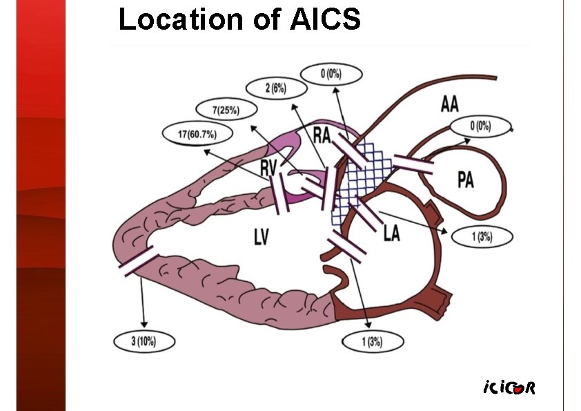 Location of AICS 