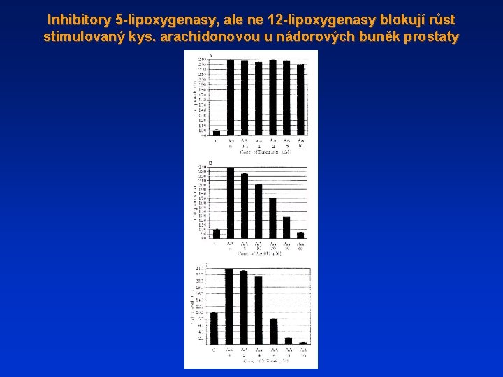 Inhibitory 5 -lipoxygenasy, ale ne 12 -lipoxygenasy blokují růst stimulovaný kys. arachidonovou u nádorových