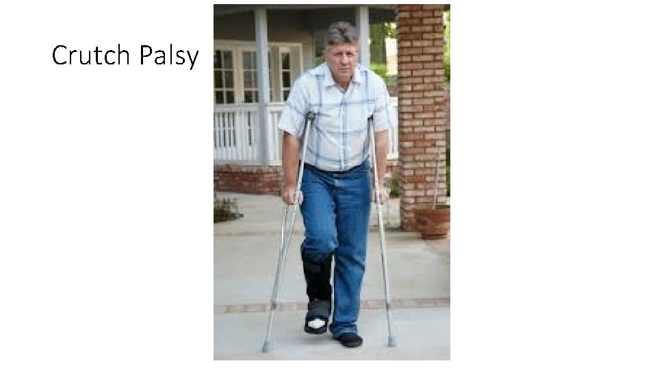 Crutch Palsy 