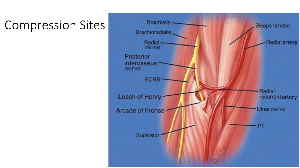 Compression Sites 