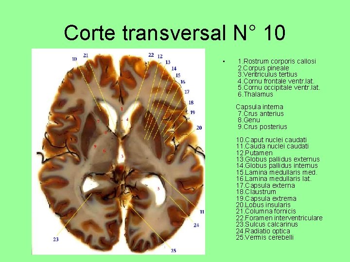 Corte transversal N° 10 • 1. Rostrum corporis callosi 2. Corpus pineale 3. Ventriculus