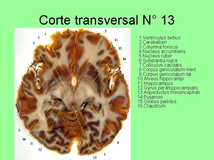Corte transversal N° 13 • 1. Ventriculus tertius 2. Cerebellum 3. Columna fornicis 4.
