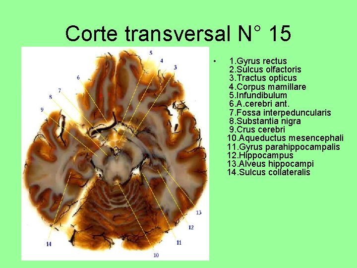 Corte transversal N° 15 • 1. Gyrus rectus 2. Sulcus olfactoris 3. Tractus opticus