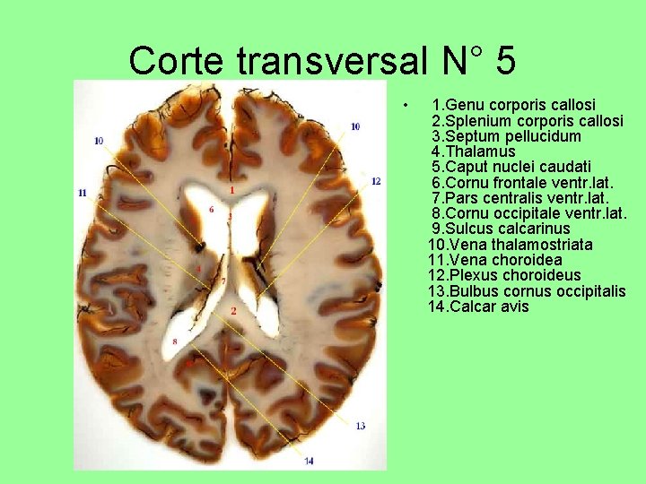 Corte transversal N° 5 • 1. Genu corporis callosi 2. Splenium corporis callosi 3.