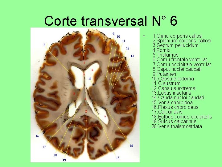Corte transversal N° 6 • 1. Genu corporis callosi 2. Splenium corporis callosi 3.