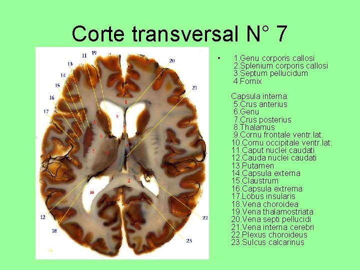 Corte transversal N° 7 • 1. Genu corporis callosi 2. Splenium corporis callosi 3.