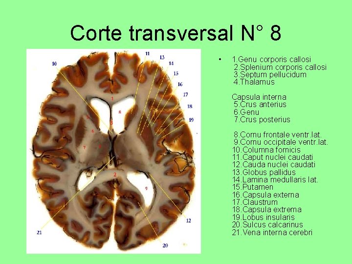 Corte transversal N° 8 • 1. Genu corporis callosi 2. Splenium corporis callosi 3.