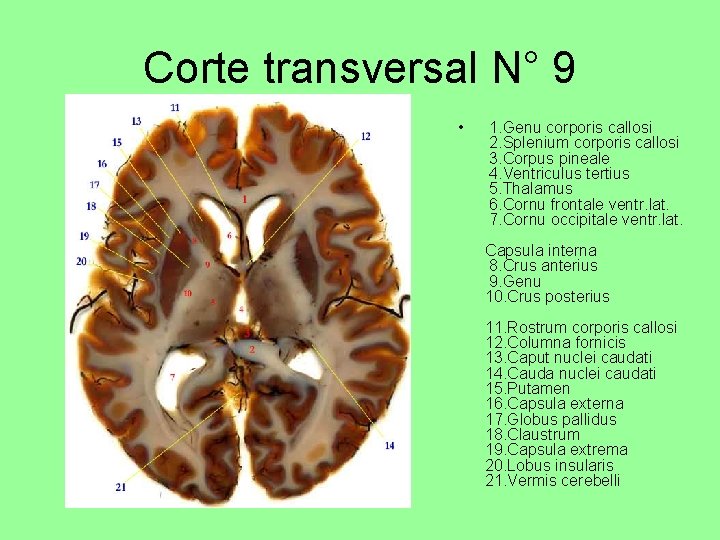 Corte transversal N° 9 • 1. Genu corporis callosi 2. Splenium corporis callosi 3.