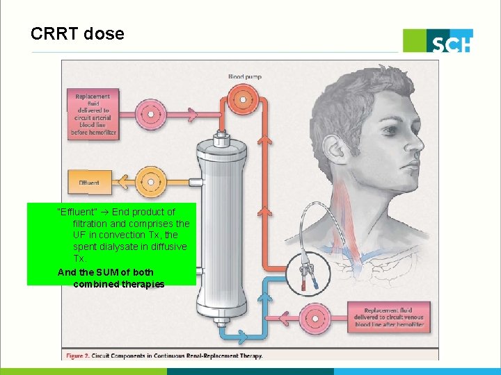 CRRT dose “Effluent” End product of filtration and comprises the UF in convection Tx,