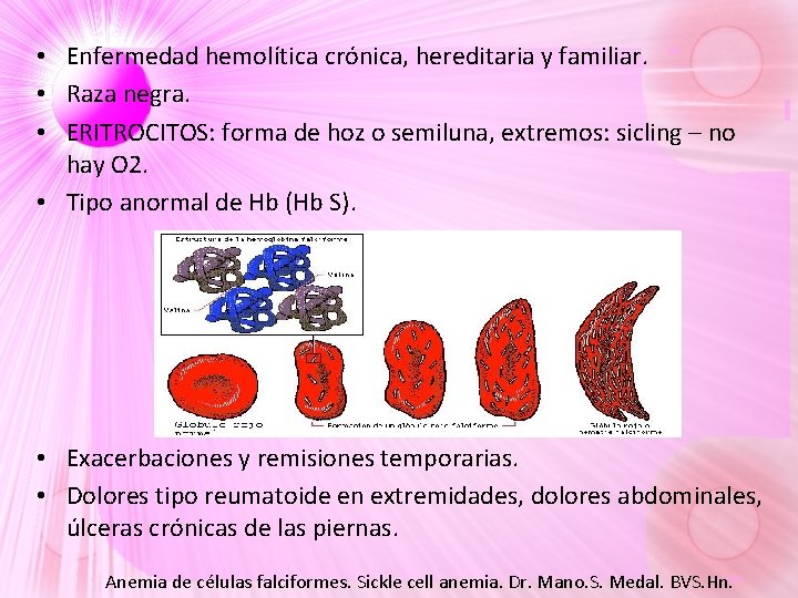 • Enfermedad hemolítica crónica, hereditaria y familiar. • Raza negra. • ERITROCITOS: forma • Enfermedad hemolítica crónica, hereditaria y familiar. • Raza negra. • ERITROCITOS: forma