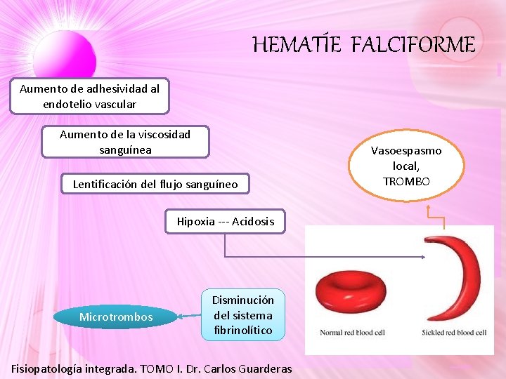 HEMATÍE FALCIFORME Aumento de adhesividad al endotelio vascular Aumento de la viscosidad sanguínea Lentificación HEMATÍE FALCIFORME Aumento de adhesividad al endotelio vascular Aumento de la viscosidad sanguínea Lentificación