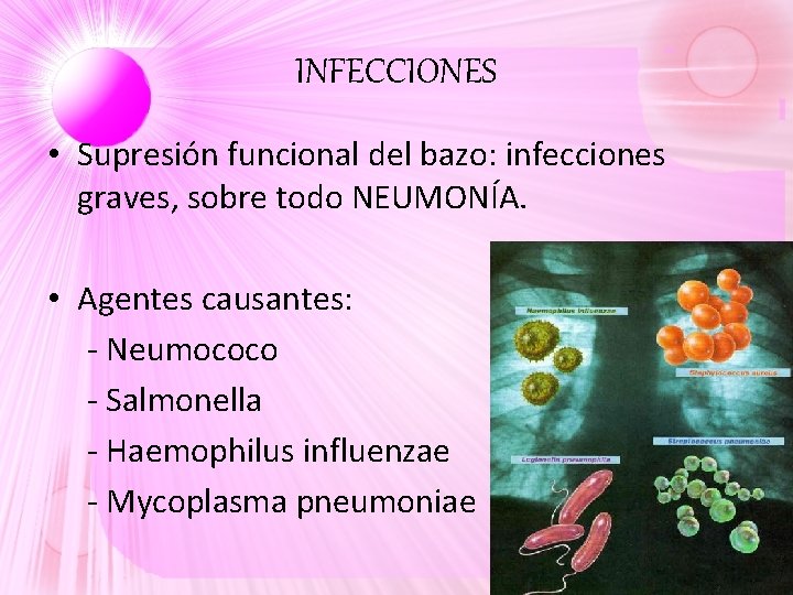 INFECCIONES • Supresión funcional del bazo: infecciones graves, sobre todo NEUMONÍA. • Agentes causantes: INFECCIONES • Supresión funcional del bazo: infecciones graves, sobre todo NEUMONÍA. • Agentes causantes: