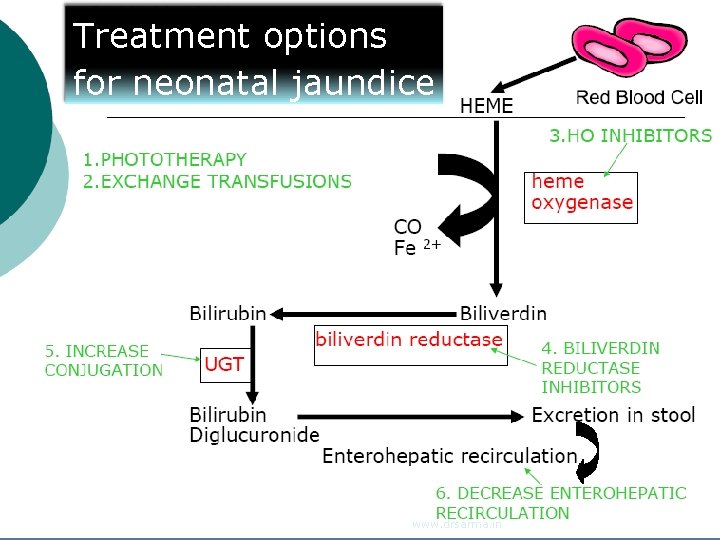 Treatment options for neonatal jaundice www. drsarma. in 33 Treatment options for neonatal jaundice www. drsarma. in 33