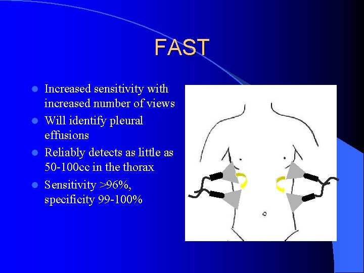 FAST Increased sensitivity with increased number of views l Will identify pleural effusions l