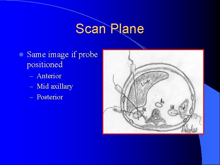 Scan Plane l Same image if probe positioned – Anterior – Mid axillary –