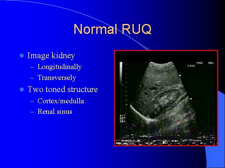 Normal RUQ l Image kidney – Longitudinally – Transversely l Two toned structure –