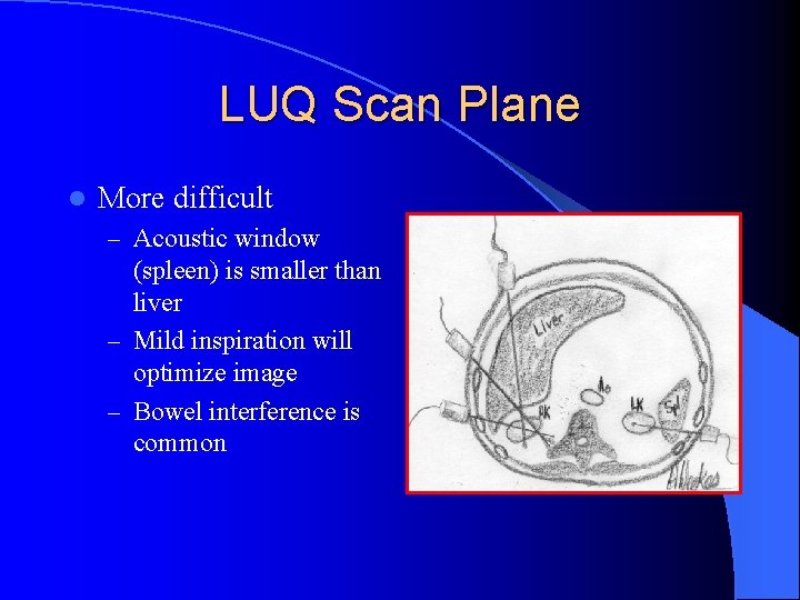 LUQ Scan Plane l More difficult – Acoustic window (spleen) is smaller than liver