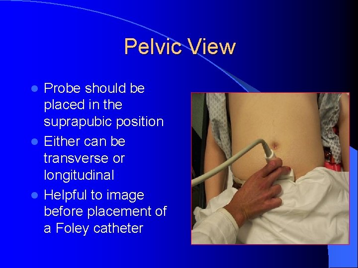 Pelvic View Probe should be placed in the suprapubic position l Either can be