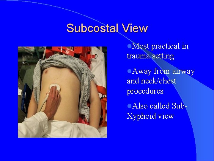 Subcostal View l. Most practical in trauma setting l. Away from airway and neck/chest