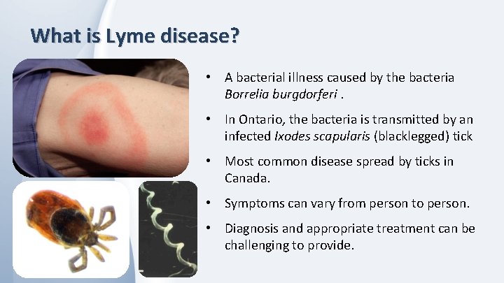 What is Lyme disease? • A bacterial illness caused by the bacteria Borrelia burgdorferi.