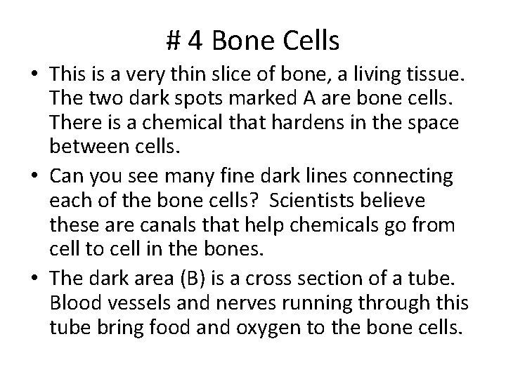 # 4 Bone Cells • This is a very thin slice of bone, a # 4 Bone Cells • This is a very thin slice of bone, a