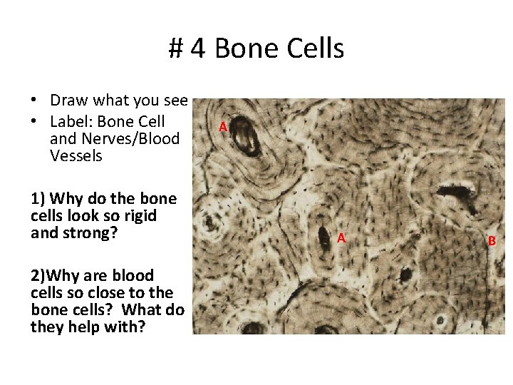 # 4 Bone Cells • Draw what you see • Label: Bone Cell and # 4 Bone Cells • Draw what you see • Label: Bone Cell and