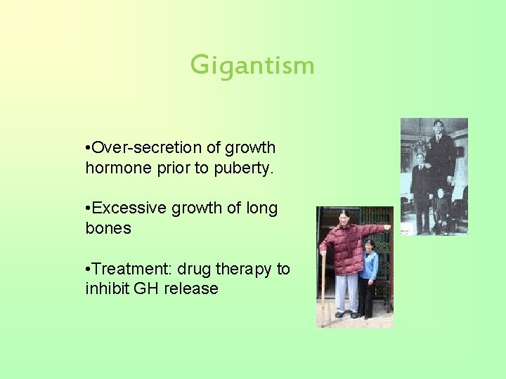 Gigantism • Over-secretion of growth hormone prior to puberty. • Excessive growth of long