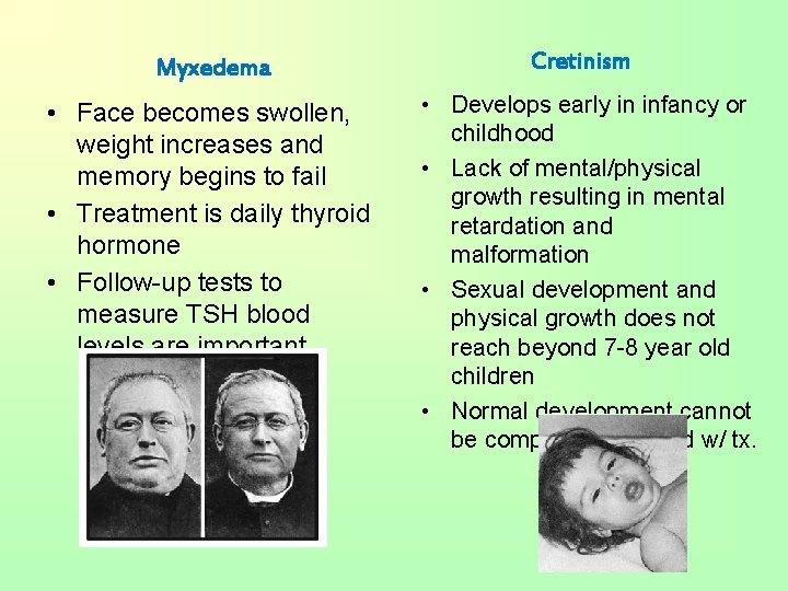 Myxedema • Face becomes swollen, weight increases and memory begins to fail • Treatment