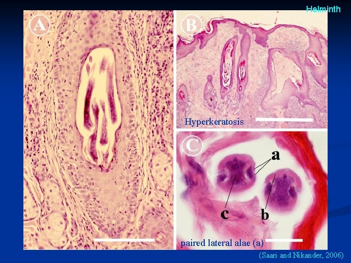 Helminth Hyperkeratosis paired lateral alae (a) (Saari and Nikander, 2006) Helminth Hyperkeratosis paired lateral alae (a) (Saari and Nikander, 2006)