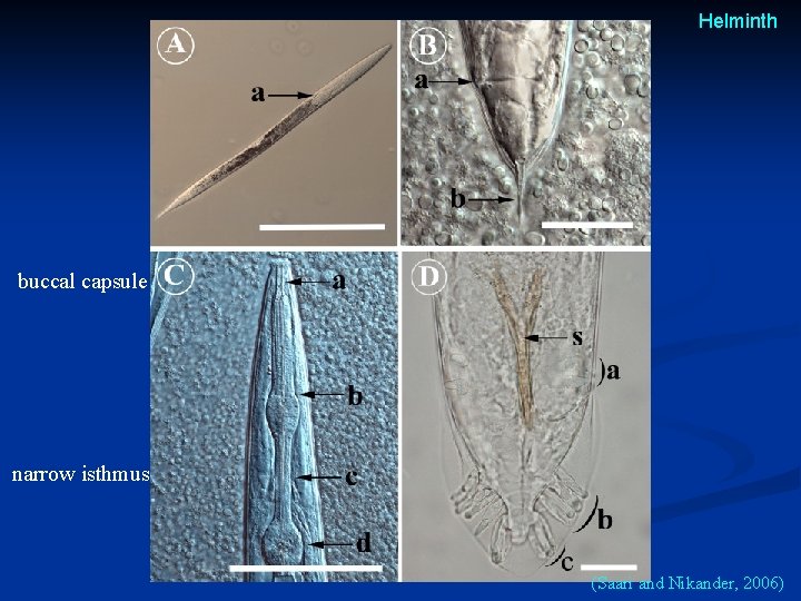 Helminth buccal capsule narrow isthmus (Saari and Nikander, 2006) Helminth buccal capsule narrow isthmus (Saari and Nikander, 2006)