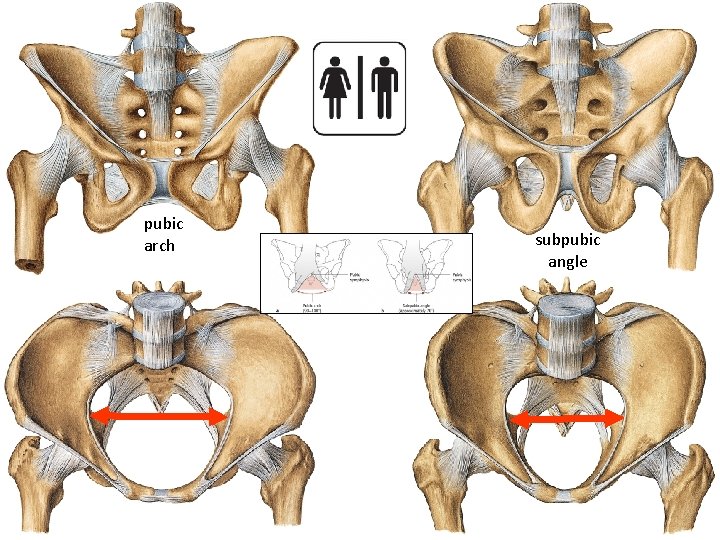 pubic arch subpubic angle 