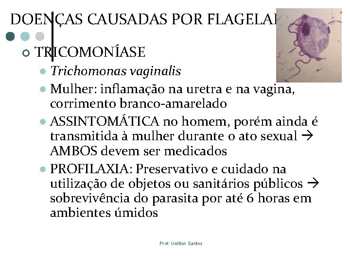 DOENÇAS CAUSADAS POR FLAGELADOS ¢ TRICOMONÍASE Trichomonas vaginalis l Mulher: inflamação na uretra e