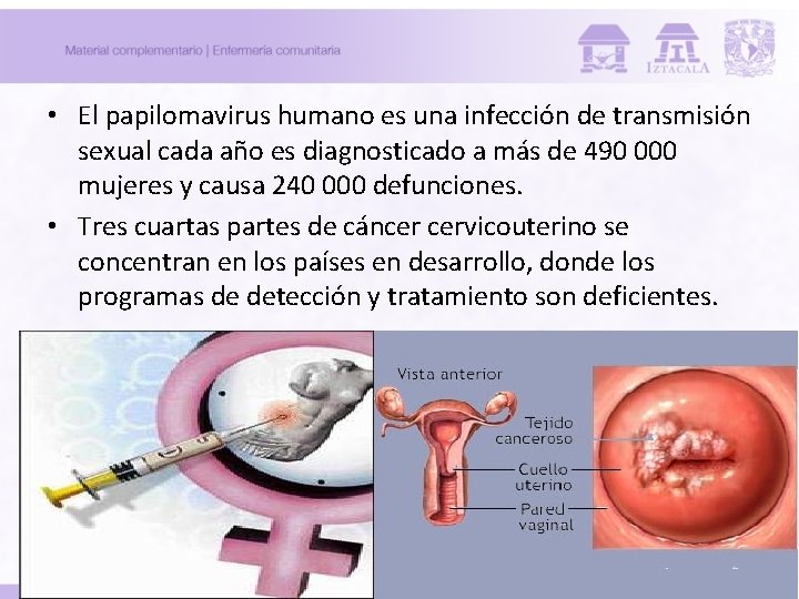 • El papilomavirus humano es una infección de transmisión sexual cada año es • El papilomavirus humano es una infección de transmisión sexual cada año es
