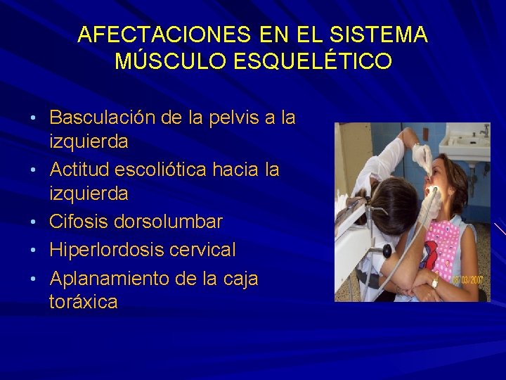 AFECTACIONES EN EL SISTEMA MÚSCULO ESQUELÉTICO • Basculación de la pelvis a la • AFECTACIONES EN EL SISTEMA MÚSCULO ESQUELÉTICO • Basculación de la pelvis a la •