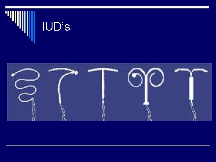 IUD’s 
