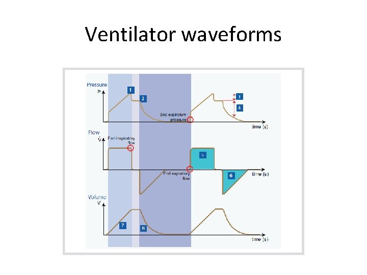 Ventilator waveforms 