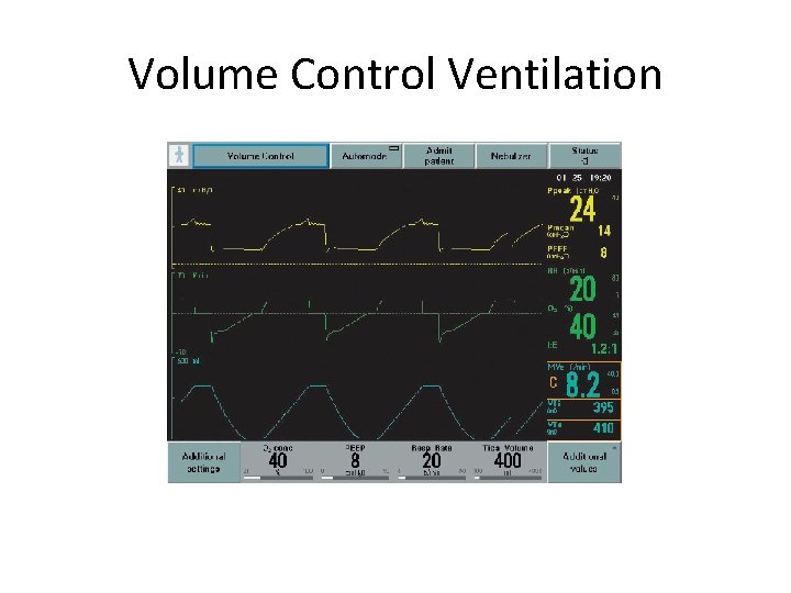 Volume Control Ventilation 