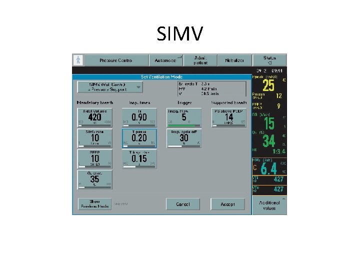 SIMV 