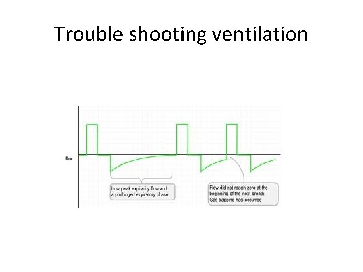 Trouble shooting ventilation 