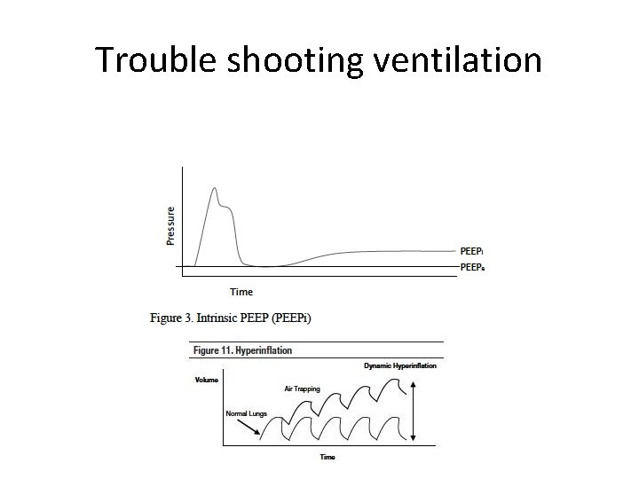 Trouble shooting ventilation 