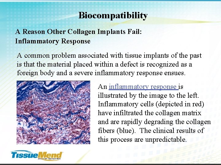 Biocompatibility A Reason Other Collagen Implants Fail: Inflammatory Response A common problem associated with