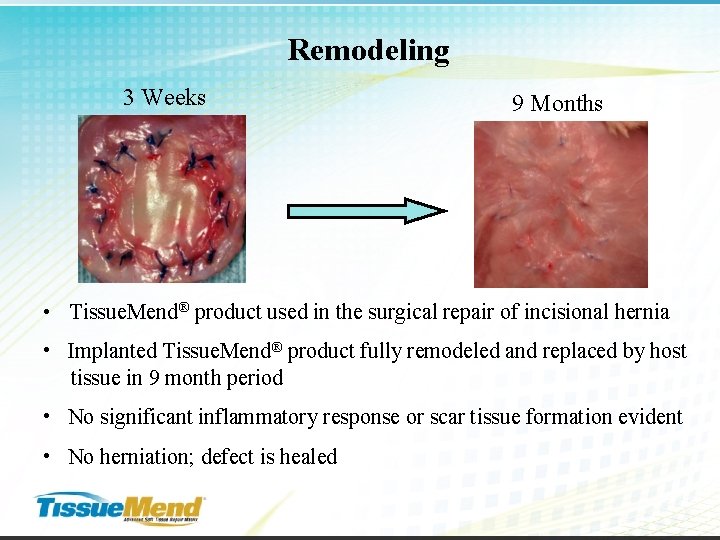 Remodeling 3 Weeks 9 Months • Tissue. Mend® product used in the surgical repair