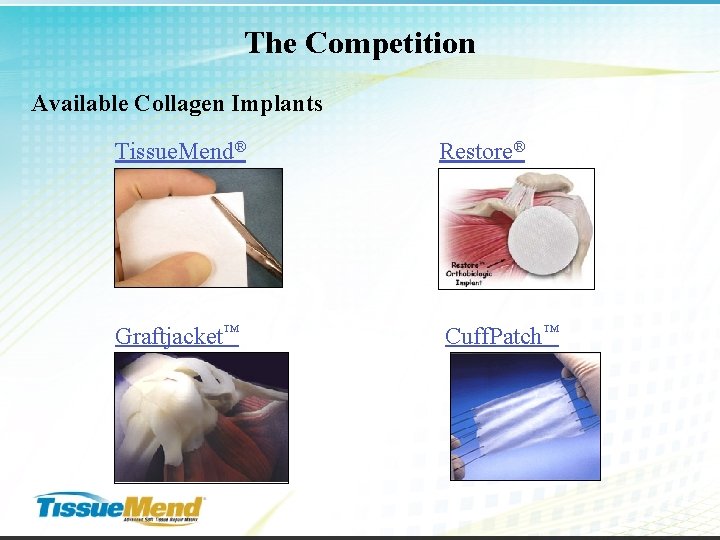 The Competition Available Collagen Implants Tissue. Mend® Restore® Graftjacket™ Cuff. Patch™ 