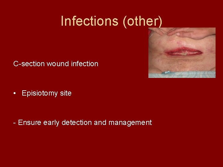 Infections (other) C-section wound infection • Episiotomy site - Ensure early detection and management