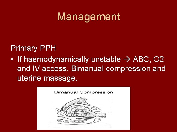 Management Primary PPH • If haemodynamically unstable ABC, O 2 and IV access. Bimanual