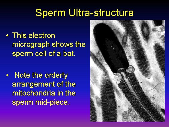 Sperm Ultra-structure • This electron micrograph shows the sperm cell of a bat. •